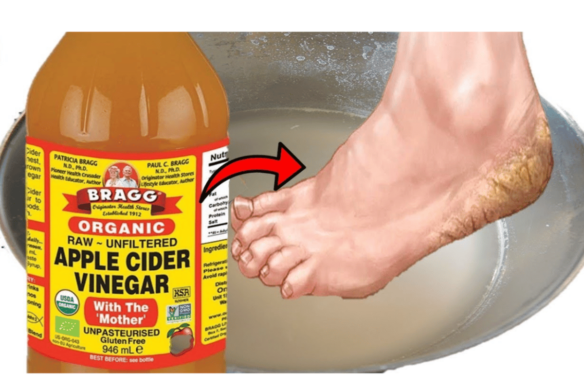 Apple Cider Vinegar on Feet 