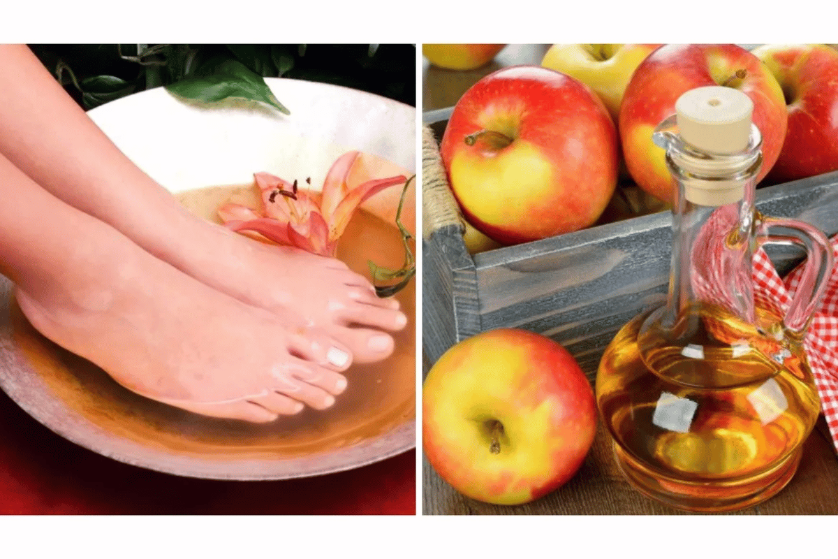 Apple Cider Vinegar on Feet 