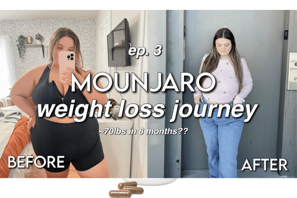 mounjaro weight loss before and after pictures