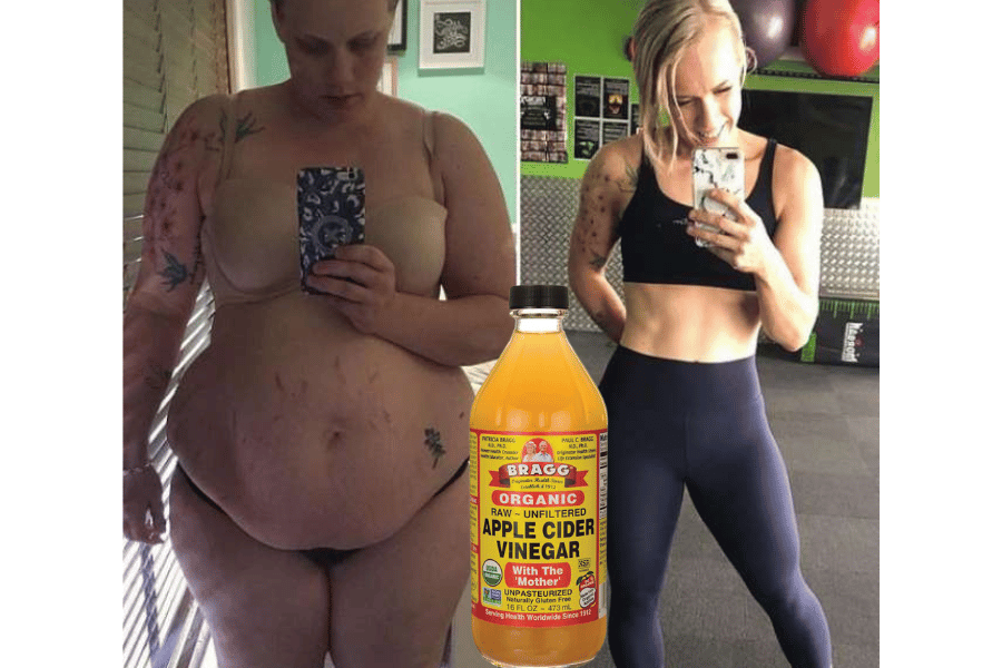 does drinking apple cider vinegar help you lose weight