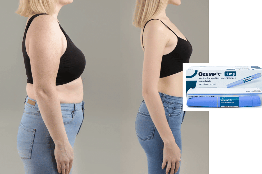 semaglutide and weight loss