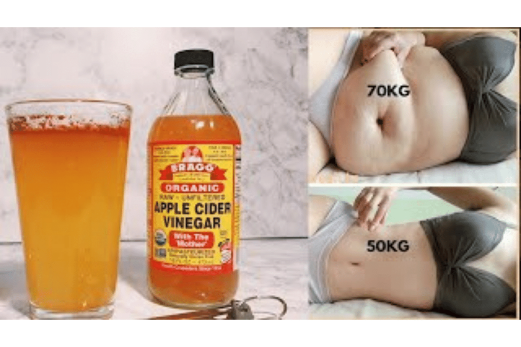 can you lose weight with apple cider vinegar