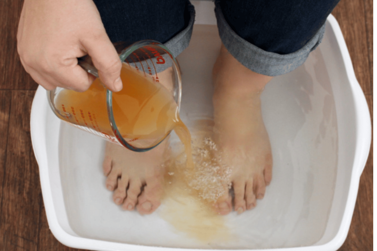 wrapping feet in apple cider vinegar to lose weight