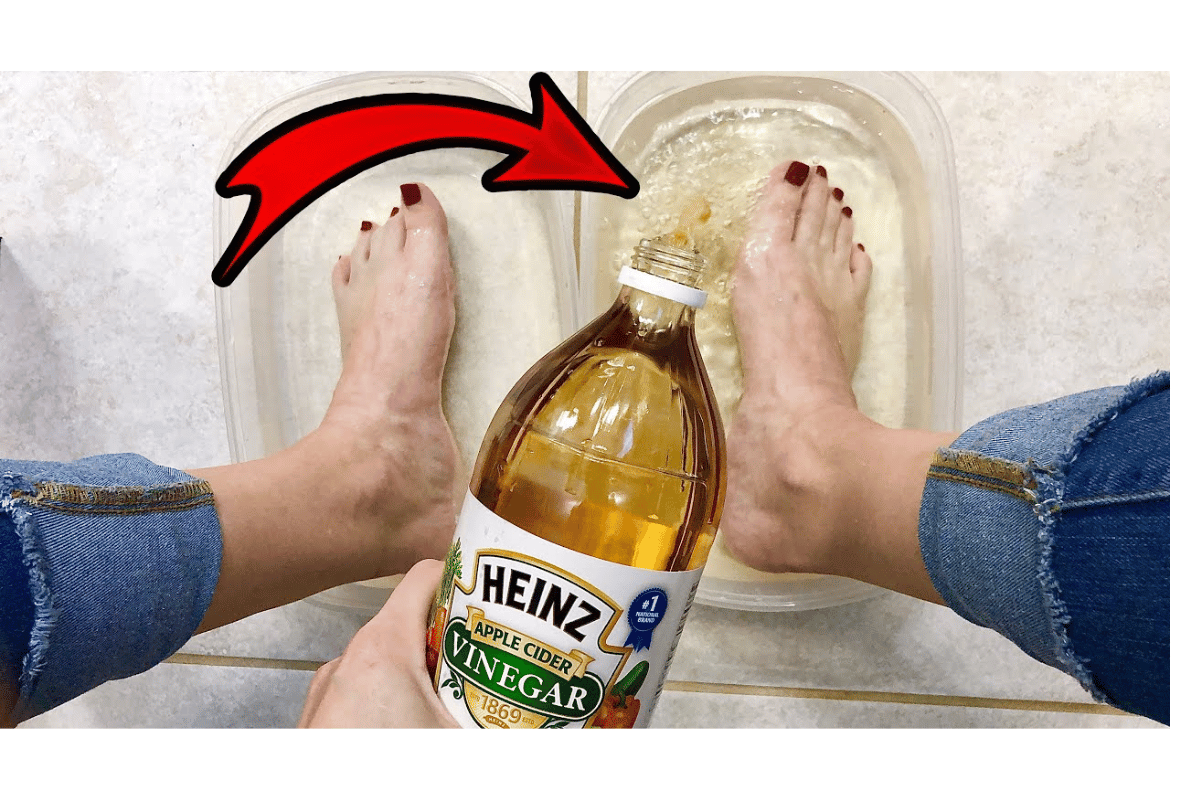 wrapping feet in apple cider vinegar to lose weight