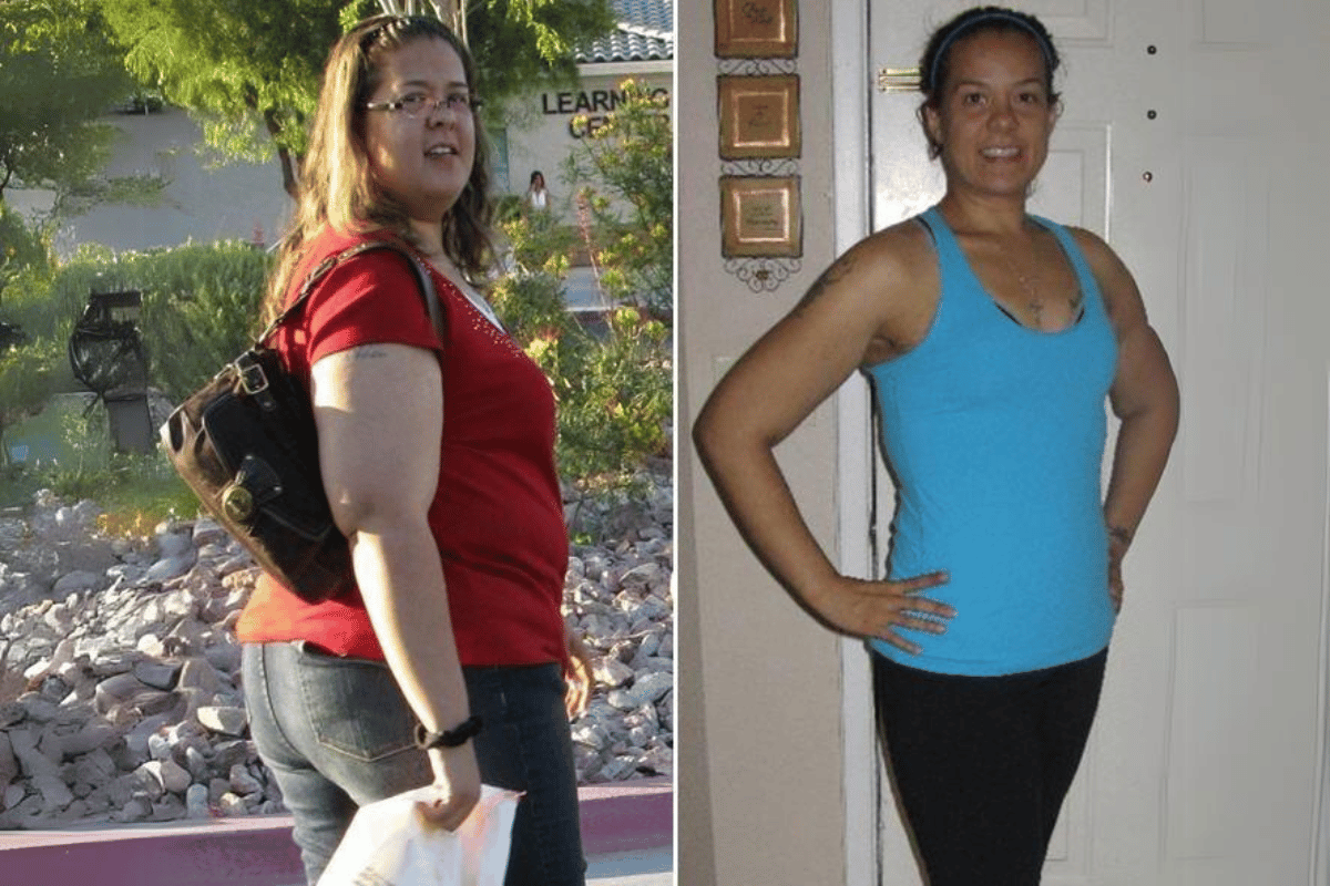 Trulicity weight loss