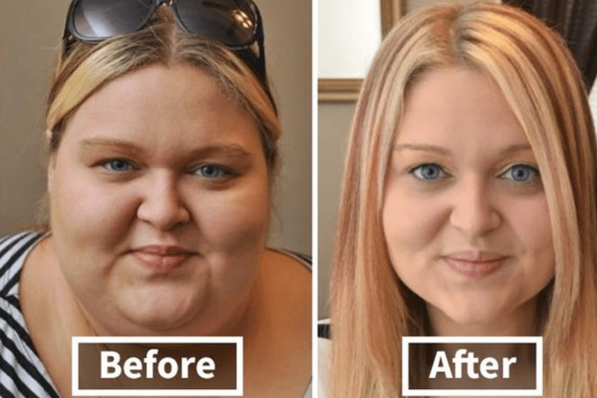 how to lose weight in your face fast 