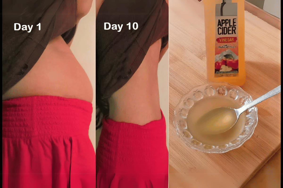 apple cider vinegar help lose weight