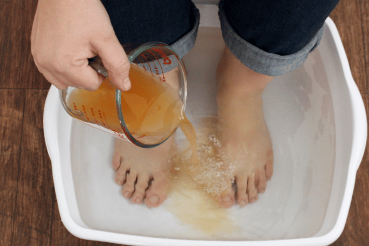 apple cider vinegar on your feet for weight loss