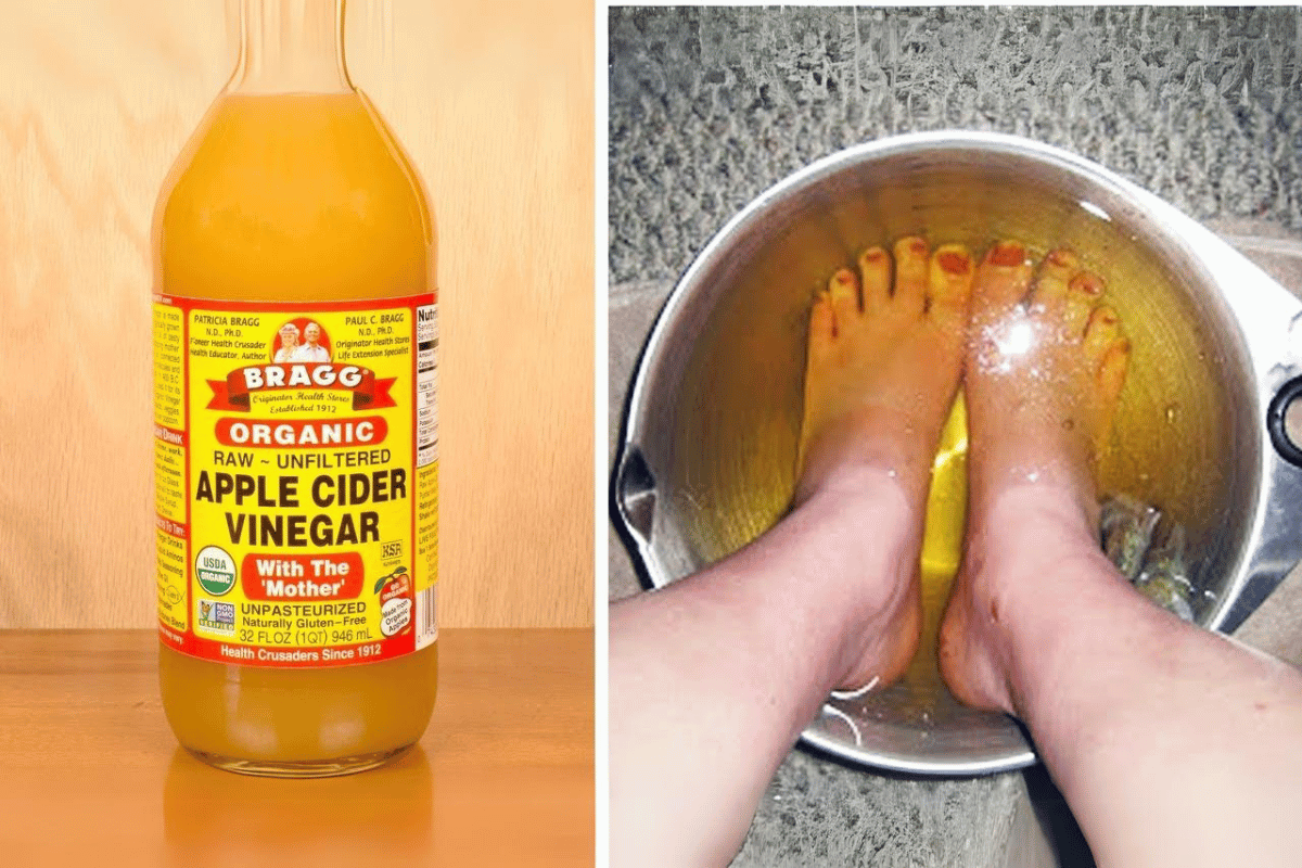 apple cider vinegar on your feet for weight loss