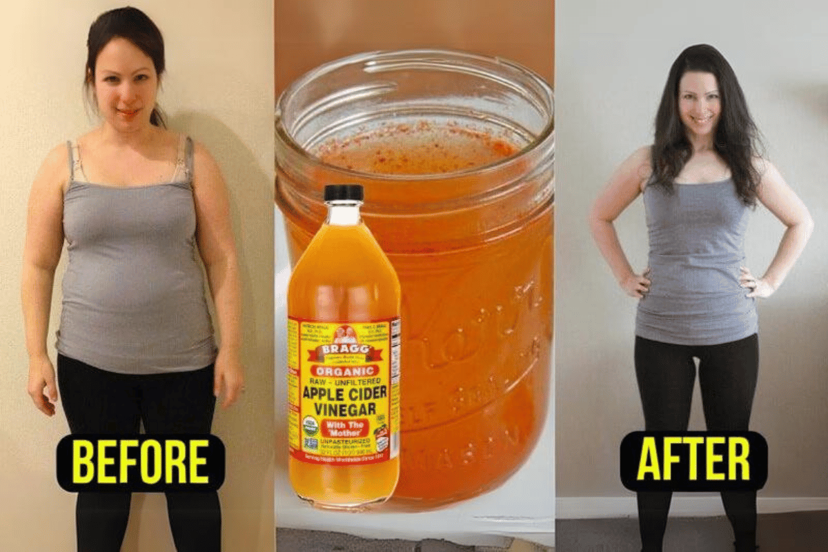 apple cider vinegar vinegar weight loss