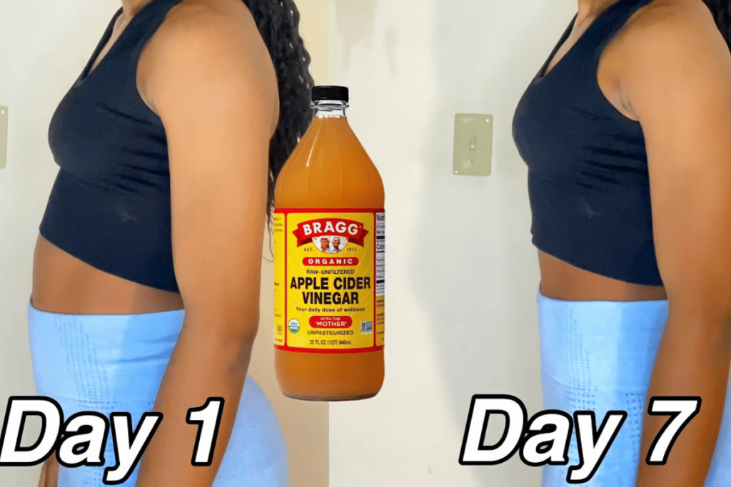 apple cider bragg weight loss