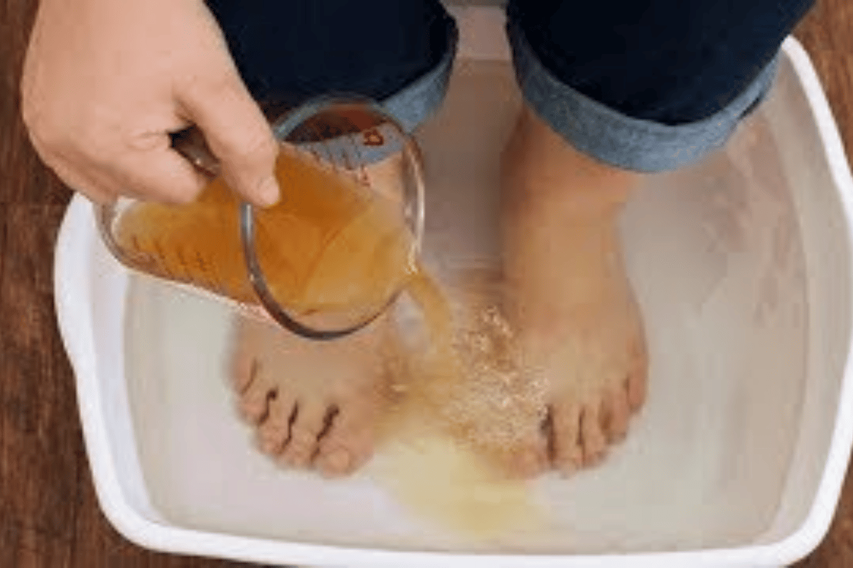 apple cider vinegar foot soak