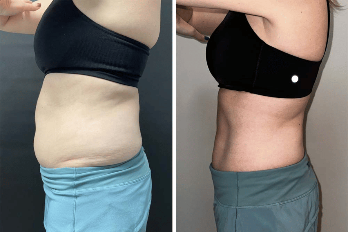 compounded tirzepatide weight loss results 