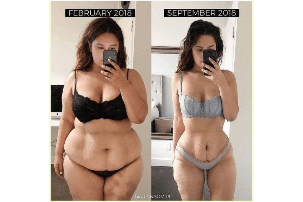 apple cider vinegar weight loss