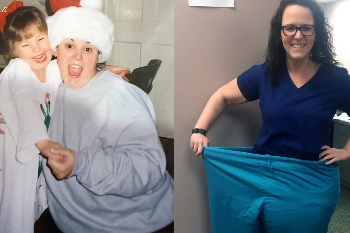 wegovy weight loss before and after pictures