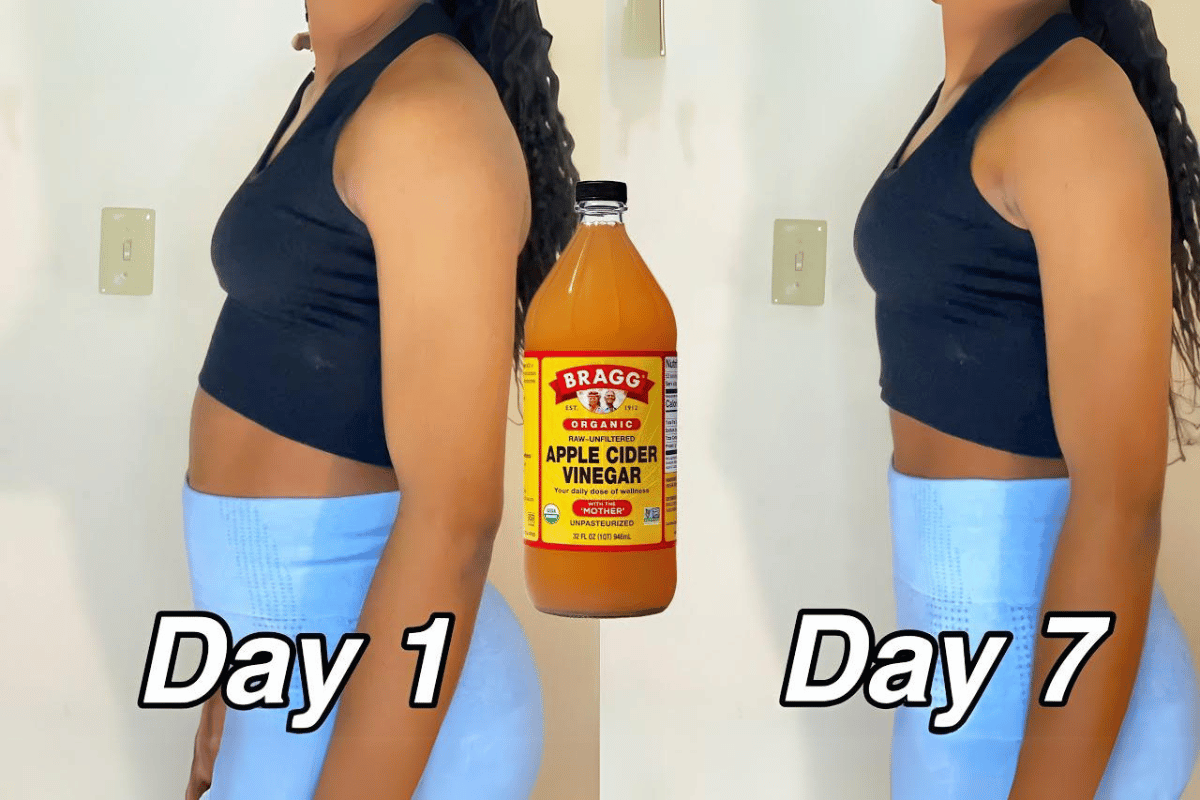 does vinegar apple cider help you lose weight