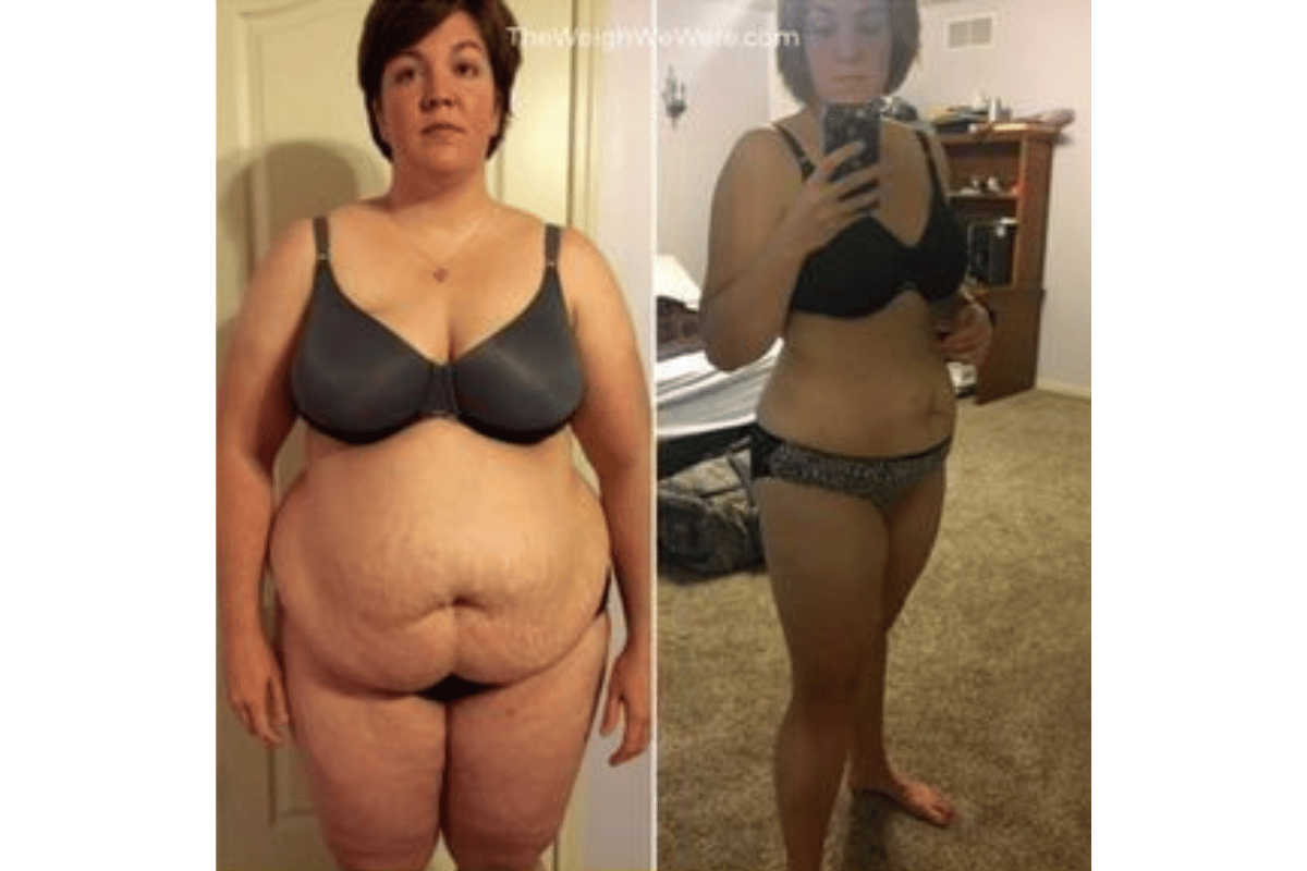 metformin before and after weight loss