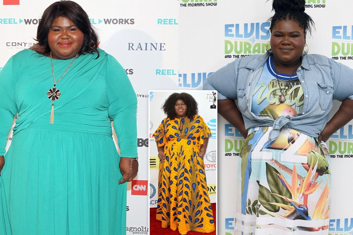 What Type of Weight-Loss Surgery Did Gabourey Sidibe Undergo?