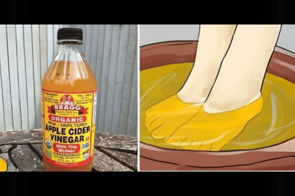 soaking feet in apple cider vinegar