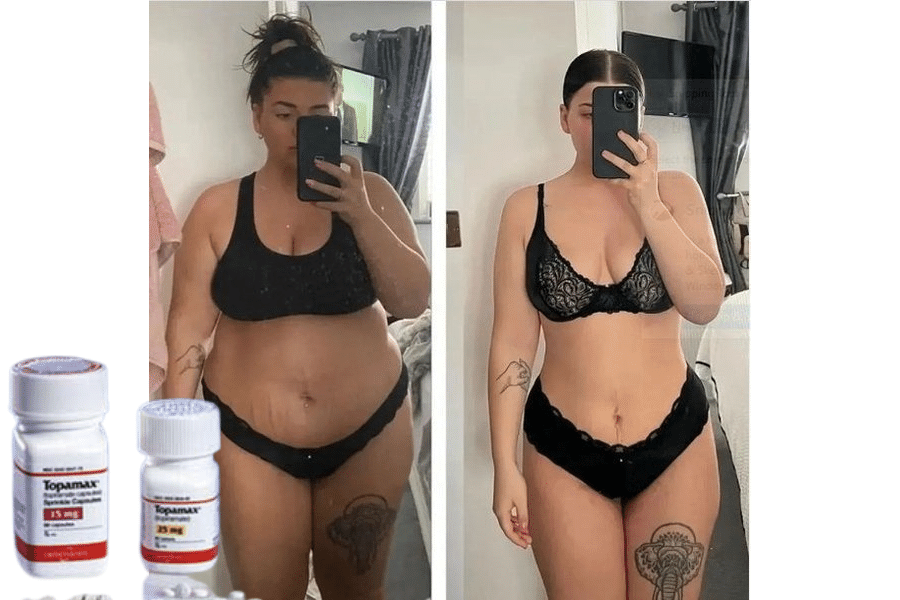 topamax weight loss