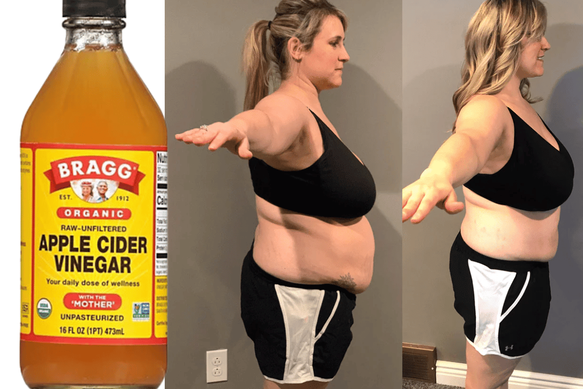 lose weight with apple cider vinegar