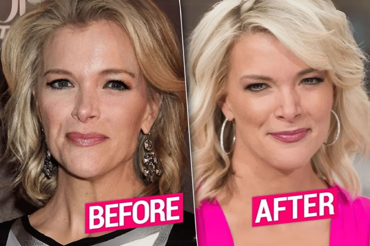 megyn kelly weight loss