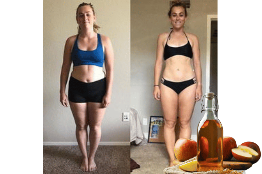 apple cider with vinegar weight loss