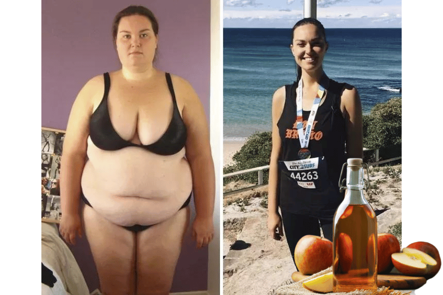 apple cider with vinegar weight loss