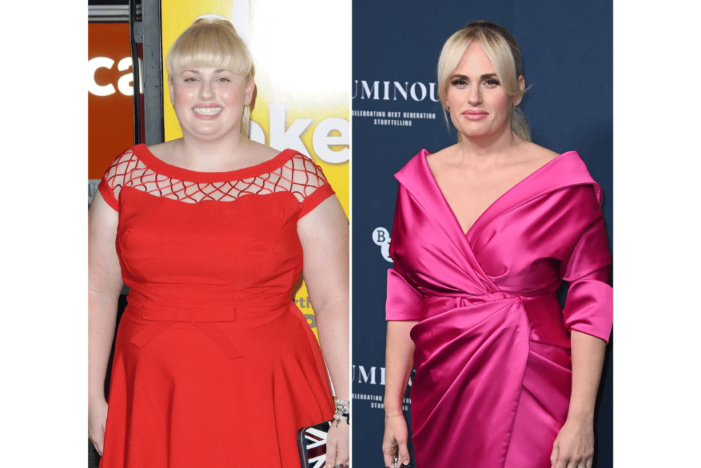 rebel wilson weight loss surgery