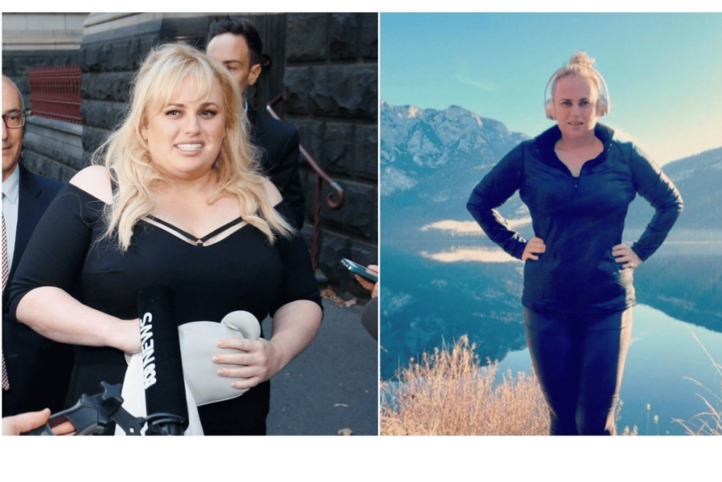 rebel wilson weight loss surgery