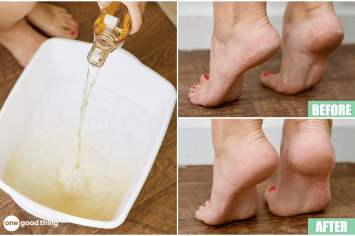 soaking feet in apple cider vinegar and epsom salt for weight loss