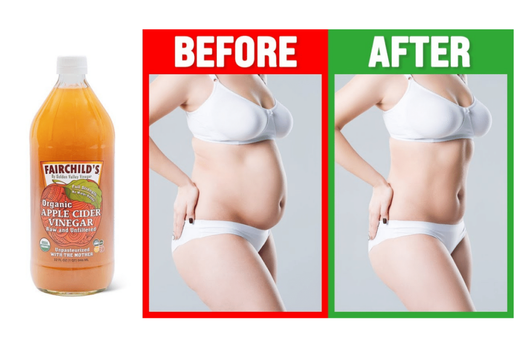 does cider vinegar make you lose weight