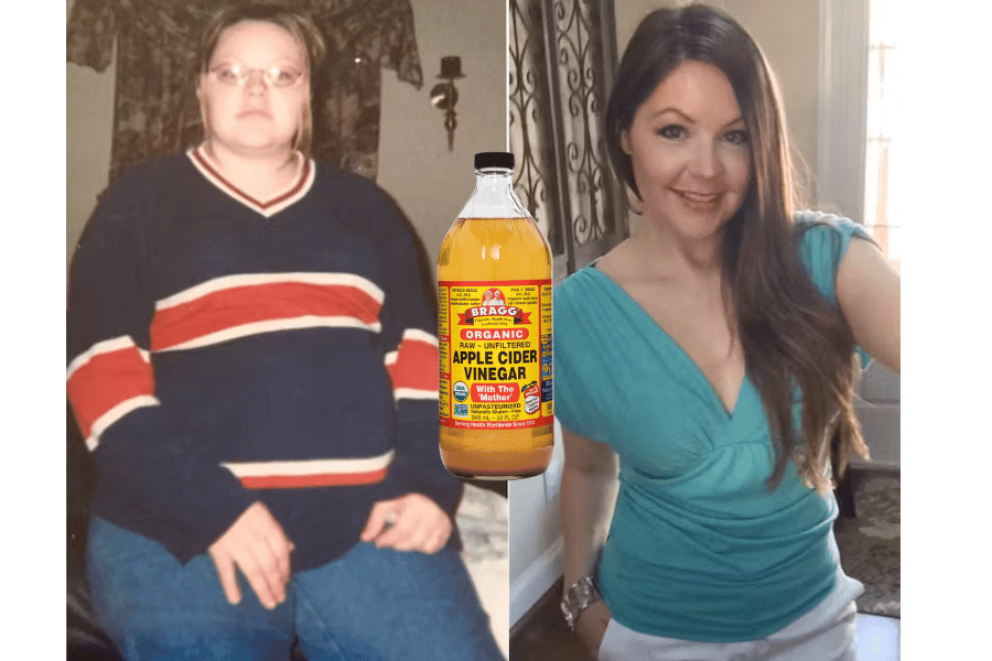 using apple cider vinegar to lose weight