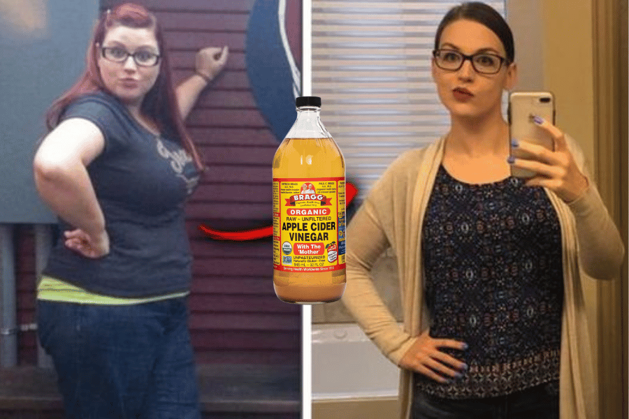 using apple cider vinegar to lose weight