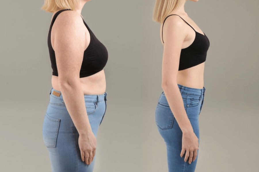 weight loss semaglutide